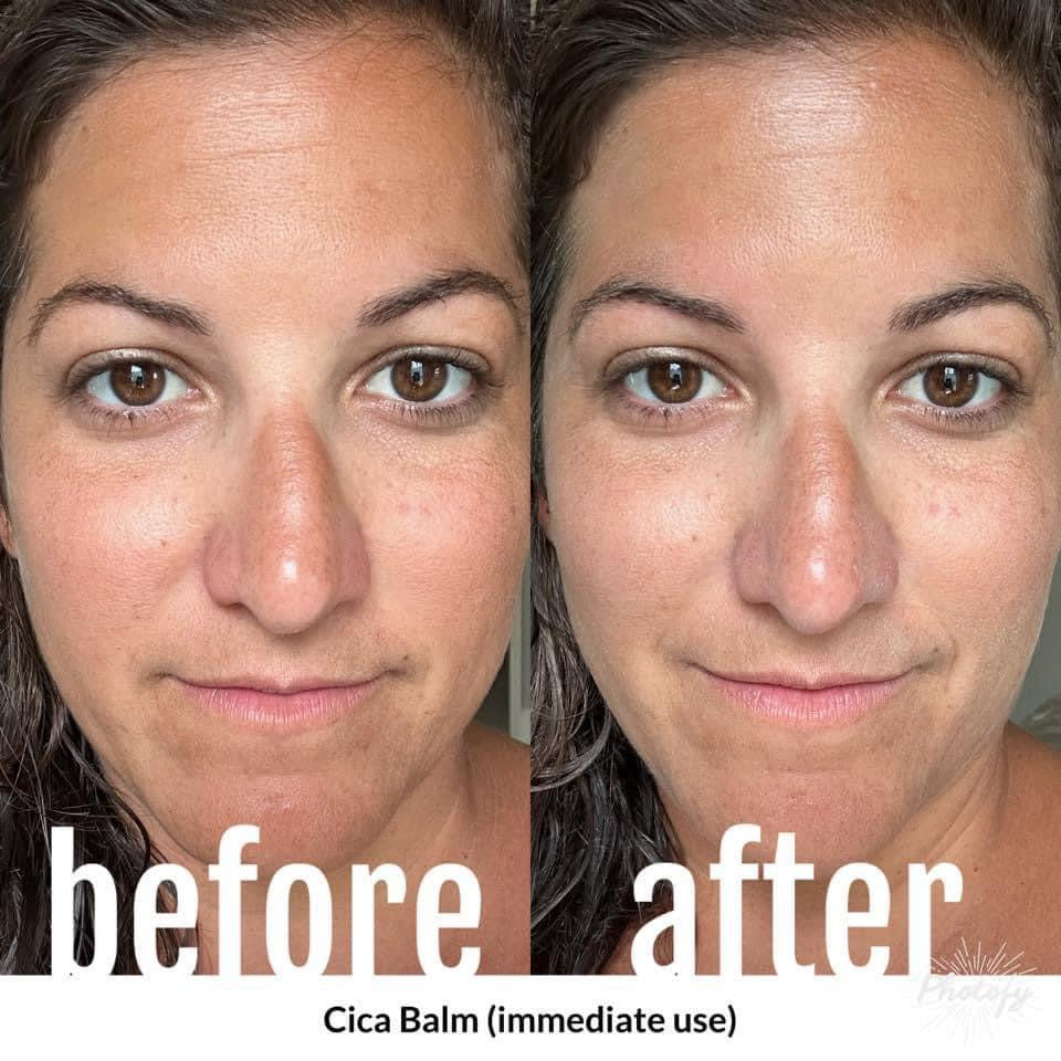 Cica Balm