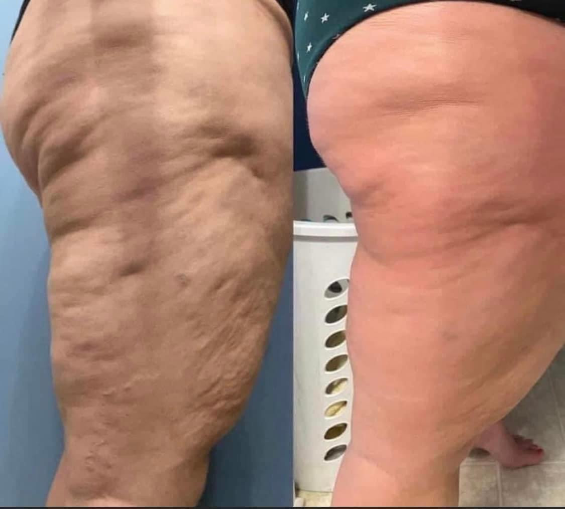 Dermatic Effects (Firming Lotion) 1 for $50, 2 for $90, 3 for $120 🔥