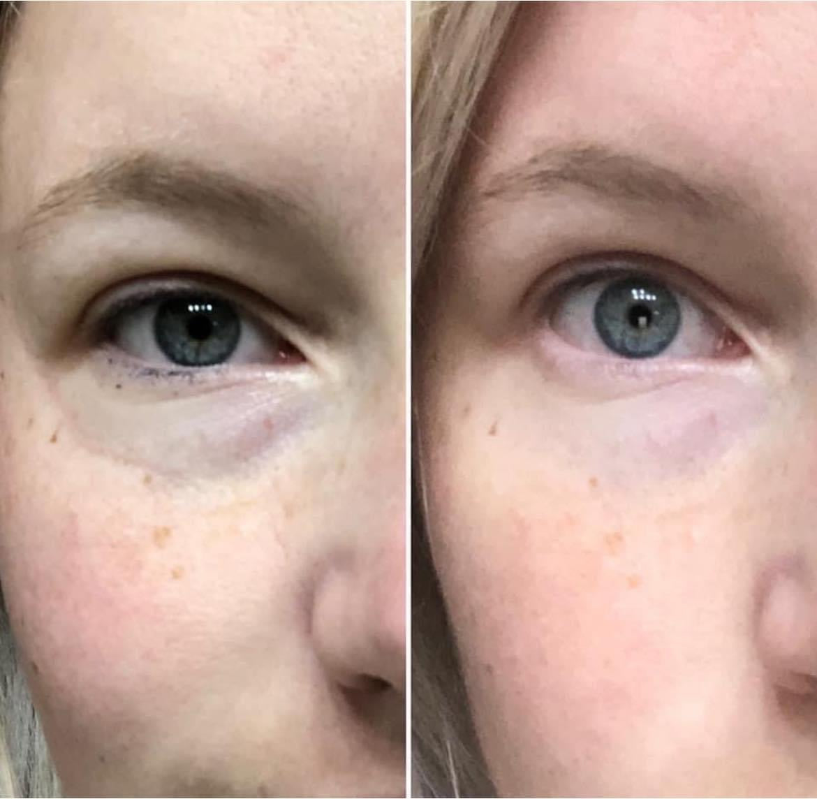 Nutricentials Clear and Balanced Kit