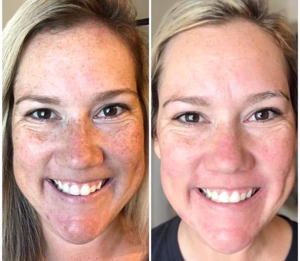 180 Face Wash (Vitamin C Wash)