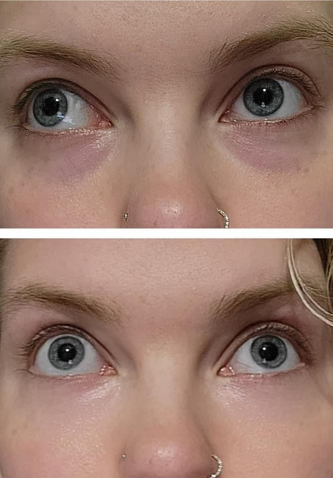 Bright Eyes Moisturizing + Brightening Eye Cream