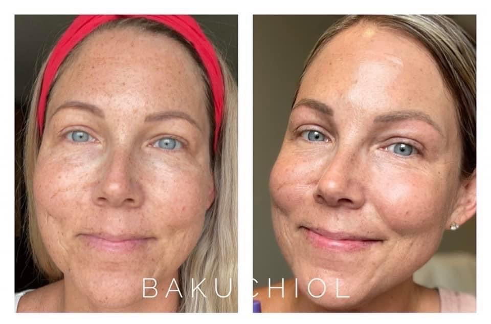 BOGO FREE! Bakuchiol/Vegan Retinol Pump (Fine Lines and Wrinkles) ✨Add one to your cart and you will receive TWO in your order✨