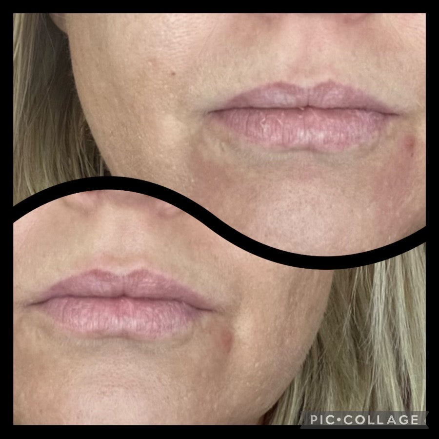 Hydrating Lip Mask - Limited Edition Gold
