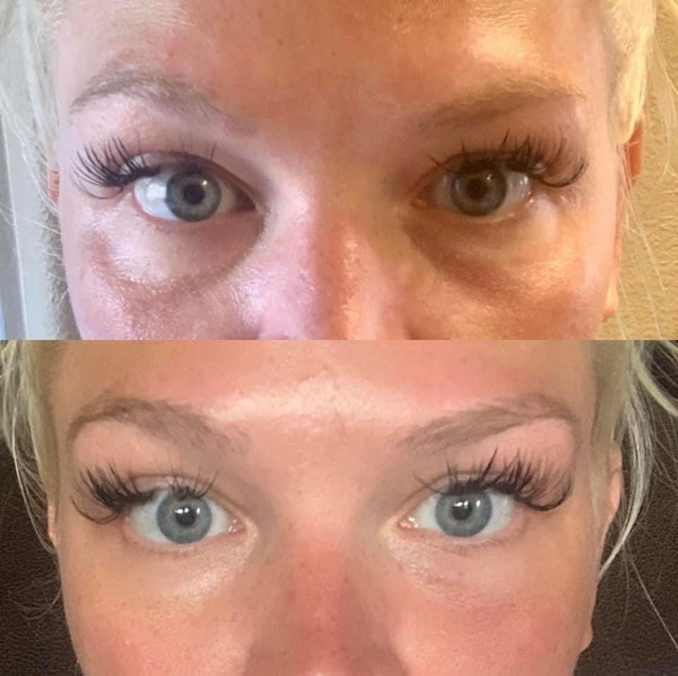 LumiSpa Accent Attachment