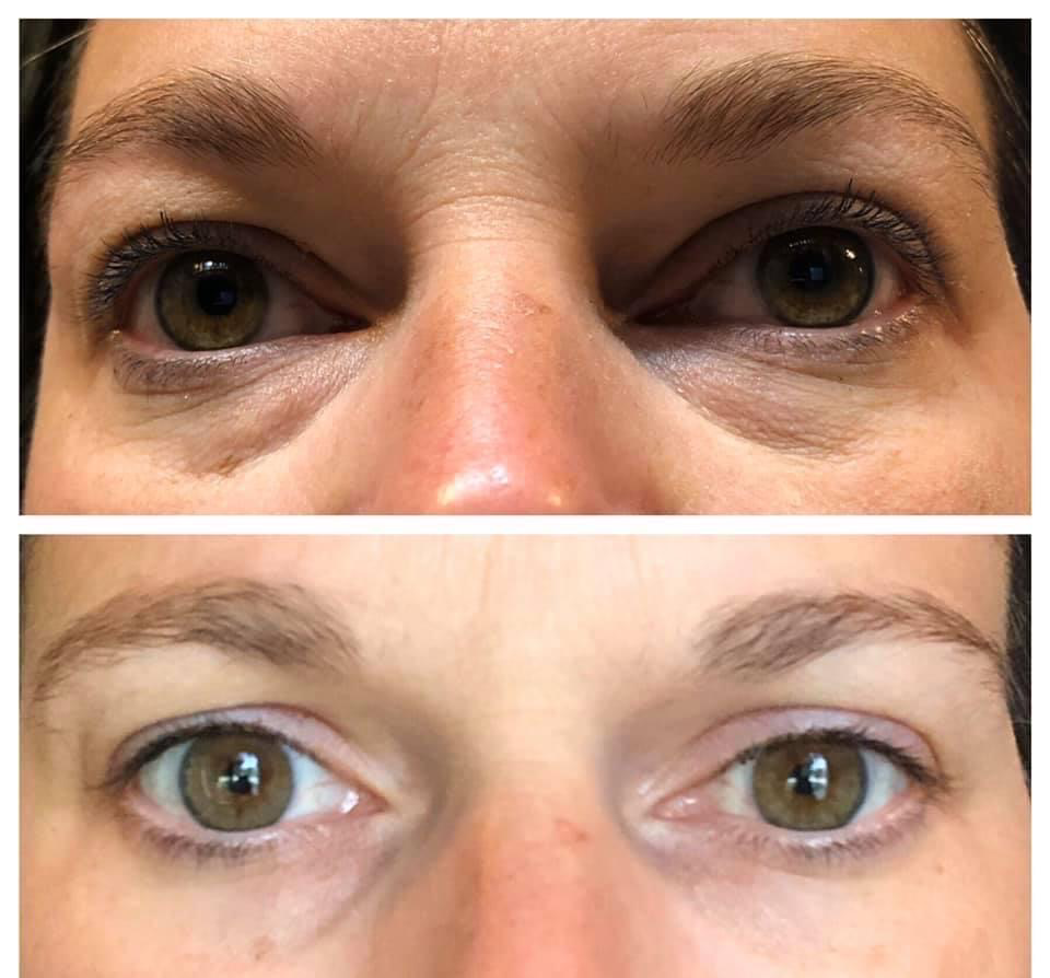 Ideal Eyes (Puffy Eye Cream)