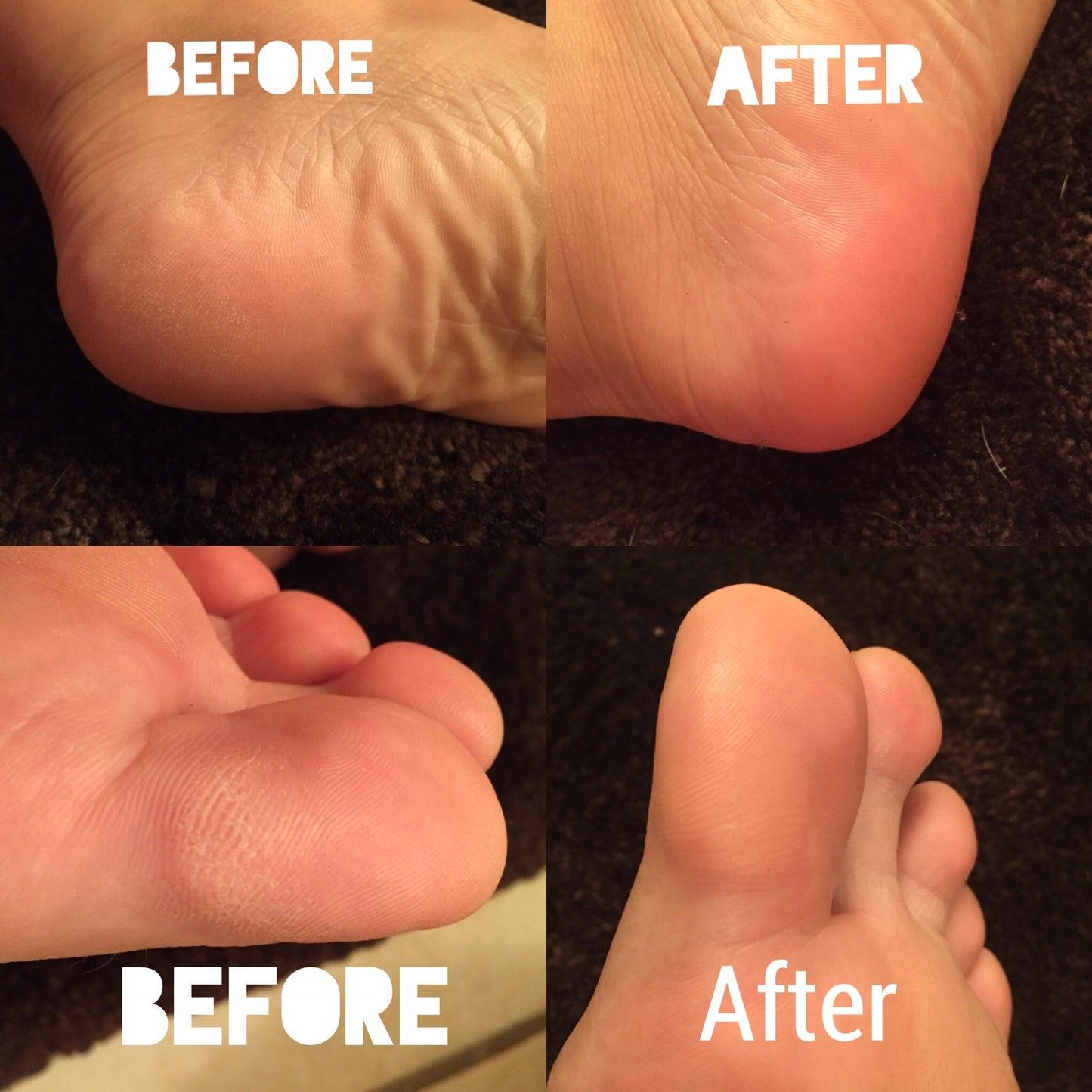 Sole Solution (Pedi in a Bottle)