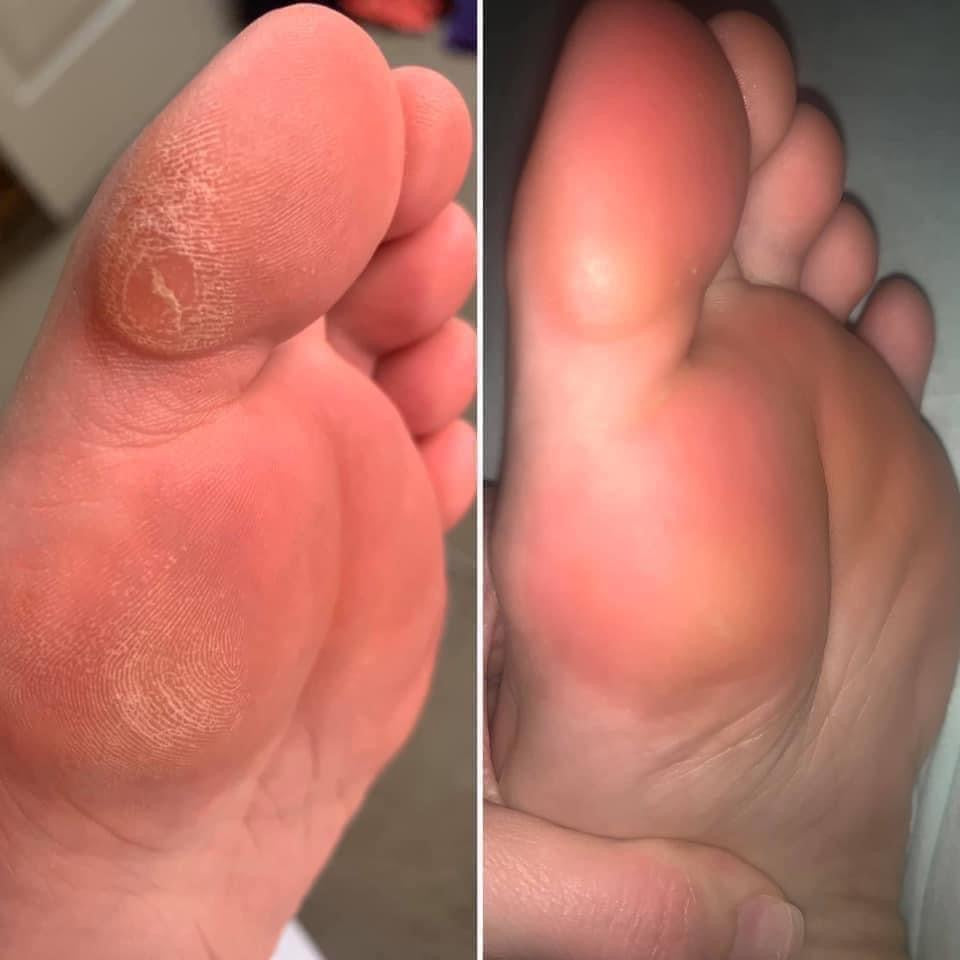 Sole Solution (Pedi in a Bottle)