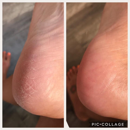 Sole Solution (Pedi in a Bottle)