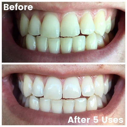 Whitening Toothpaste