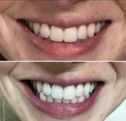 Whitening Toothpaste